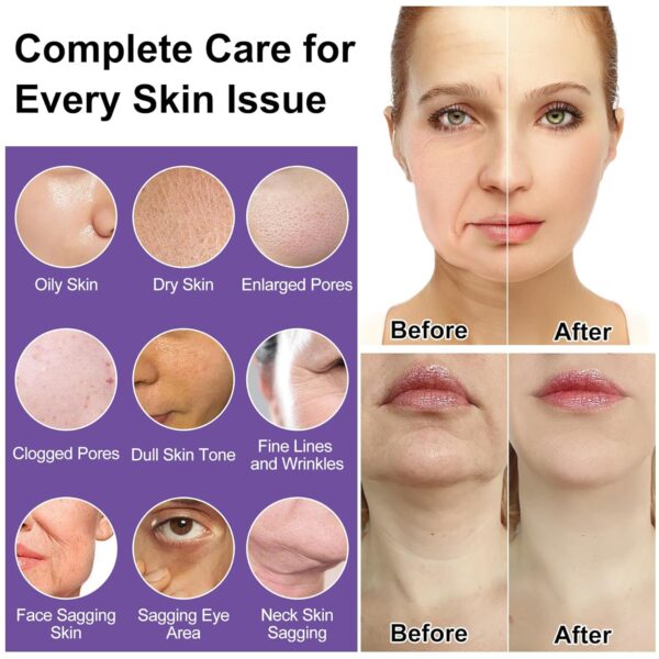 Skin Care Set,Professional Tighten Lift Firm Skincare for Women Teens Teenage Girl,Hydrate Anti-Aging Facial Skin Care Routine Kit,Travel Skincare Gift Set,Wife Mom Womens Gifts for Christmas Birthday - Image 2