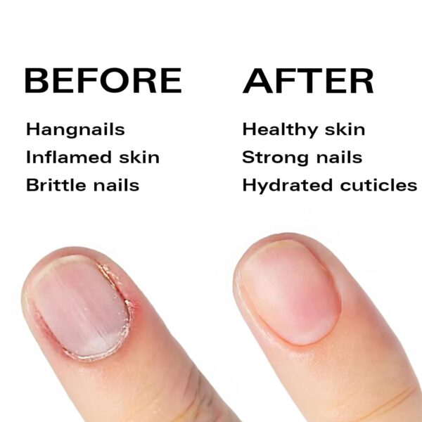 Nail Oil Cuticle Pen - Fragrance Free - Nail Strengthener & Growth Serum with Vitamin A, D, E, B5, Grapeseed & Natural Oils - Repair for Brittle, Peeling, Thin Nails (No Scent) - Image 8