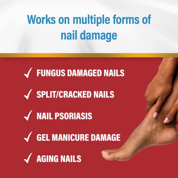 Kerasal Multi-Purpose Nail Repair, Nail Solution for Discolored and Damaged Nails, 0.43 fl oz - Image 2