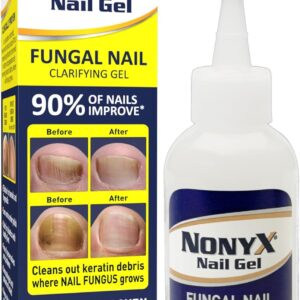 Nail Clarifying Gel | Clinically Proven for Discolored and Damaged Toenails | Restores the Appearance of Thick, Brittle, Yellow or Lifted Nails | Effective Nail Care Treatment | Made in the USA