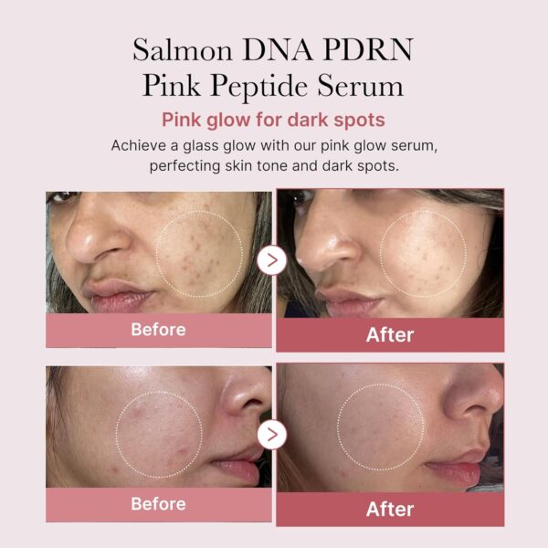 medicube Salmon DNA PDRN Pink Peptide Serum, Pink glow serum, Peptide, Niacinamide, Hydrating & Moisturizing & Firming, Uneven Skin Tone, Korean Skincare | 1.01 fl.oz. (1.01 fl.oz., Salmon DNA PDRN) - Image 2
