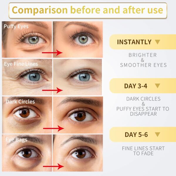 24K Gold Under Eye Patches - 60 Pack for Puffy Eyes, Dark Circles, Bags & Wrinkles with Collagen & Hyaluronic Acid - Image 3