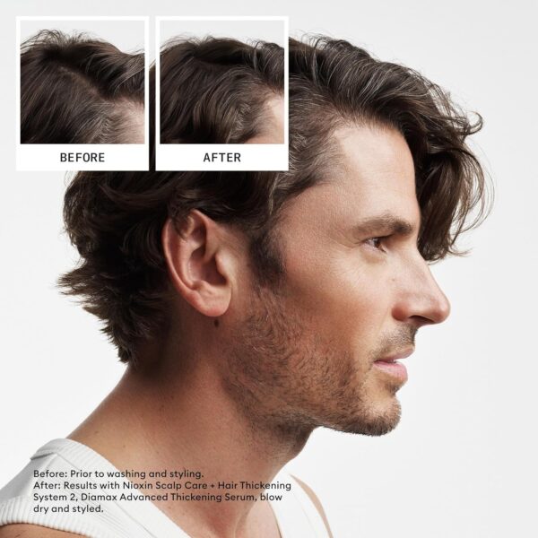 Nioxin Scalp + Hair Thickening System Kits | For Natural, Colored, & Damaged Hair with Light to Progressed Thinning | Strengthen & Boost Hair Density with Niacinamide & Biotin | 1 Month Supply - Image 3